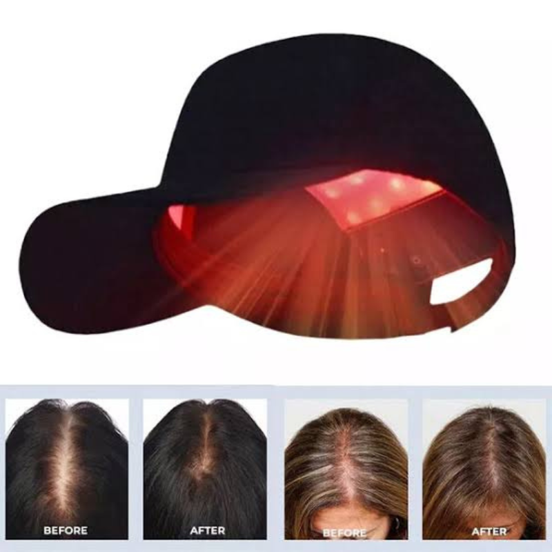 LightRestore™ Infrared Therapy Hat