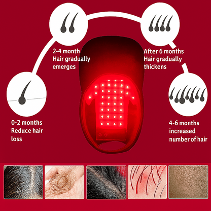 LightRestore™ Infrared Therapy Hat